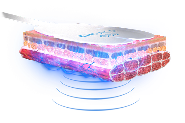 Emface_PIC_Web-product-page-RU100