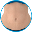 Emsculpt_Neo_ICON_Female-abdomen_100