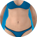 Emsculpt_Neo_ICON_Female-abdomen_100