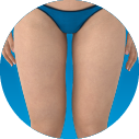Emsculpt_Neo_ICON_Female-front-thighs_100