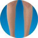 Emsculpt_Neo_ICON_Female-legs_100_v2