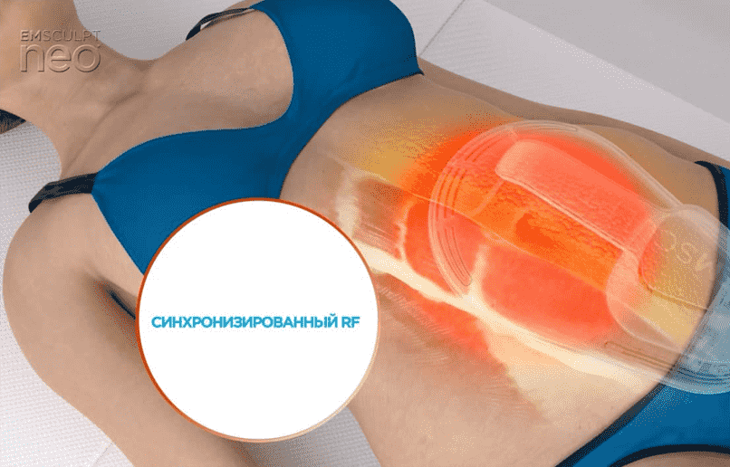 Emsculpt_Neo_PIC_Moa-Animation_806x516_RU100