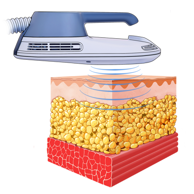 Emsculpt_PIC_Web-product-page-applicator_400x400_EN100