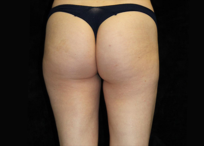 До процедур EMTONE