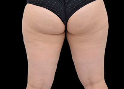 До процедур EMTONE