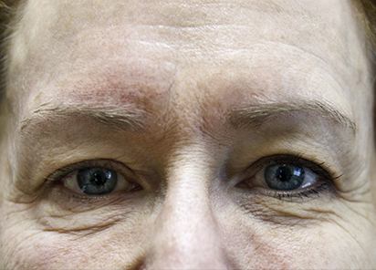 До процедур EXILIS