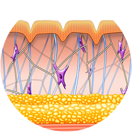 Exilis_Ultra_360_PIC_Moa-web-before_264x264_100