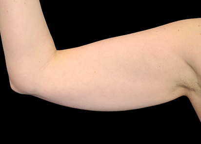 До процедур EXILIS