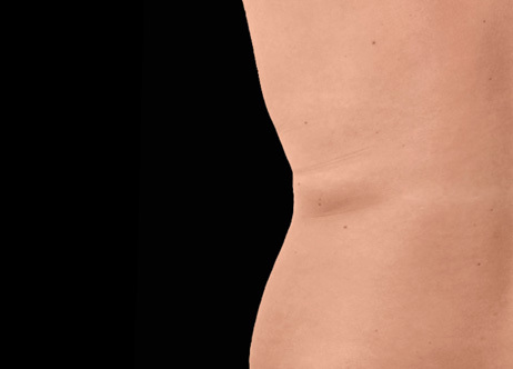 Exion_PIC_Ba-card-back-female-012_Body_After_ENUS100