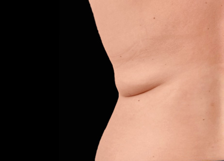 Exion_PIC_Ba-card-back-female-012_Body_Before_ENUS100