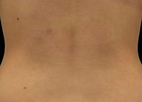 Exion_PIC_Ba-card-back-female-024_FRF_After_ENUS100