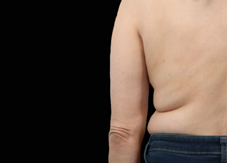 Exion_PIC_Ba-card-back-female-036_Body_Before_ENUS100