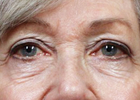 Exion_PIC_Ba-card-eyes-female-009_FRF_Before_ENUS100