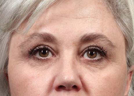 Exion_PIC_Ba-card-eyes-female-014_FRF_Before_ENUS100