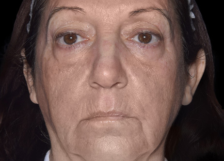 Exion_PIC_Ba-card-face-female-060_Face_Before_ENUS100